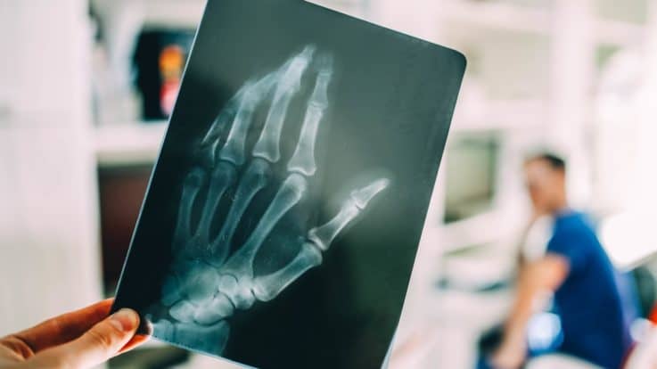 The History of X-Rays: How an Accidental Discovery Changed the World