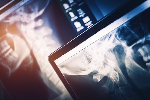 Radiology On The Rise: Advancements In The Field