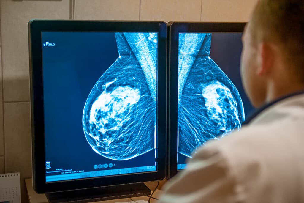 A person looking at images from a mammogram in El Paso.
