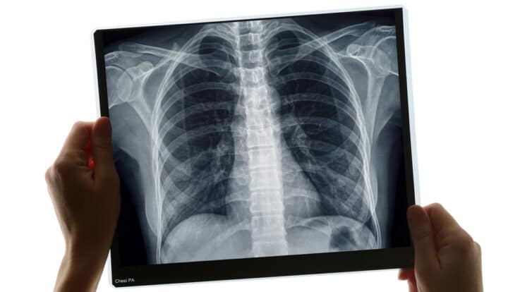 Navigating Treatment Options: How X-rays Guide Personalized Care Plans